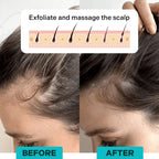 Moriqo Soothe Electric Scalp Massager