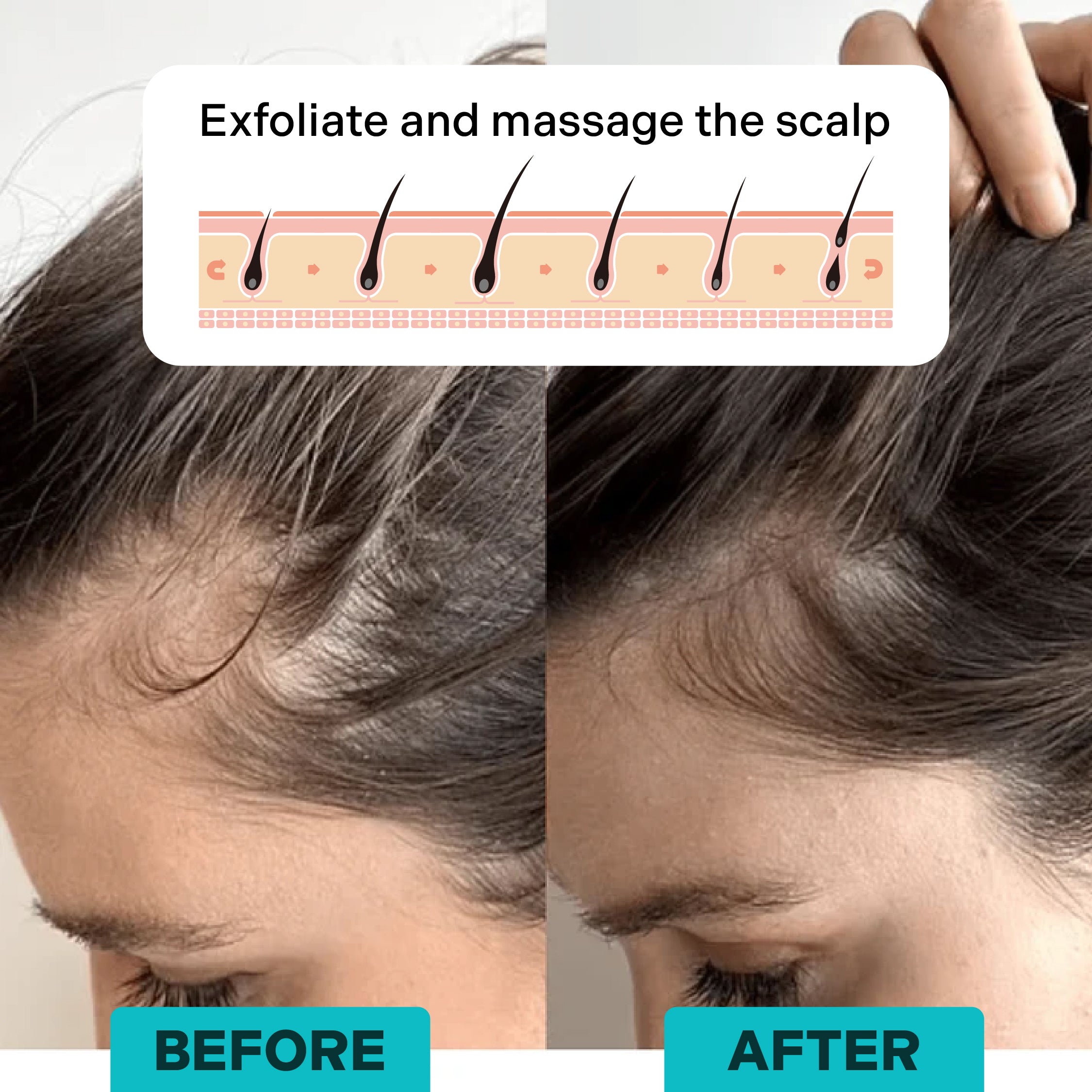 Moriqo Soothe Electric Scalp Massager