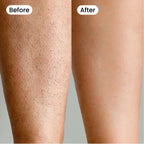 Moriqo IPL Hair Removal