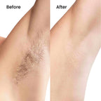 Moriqo IPL Hair Removal